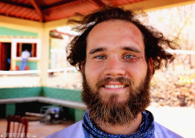 #Cerro Negro_Neil wounded1